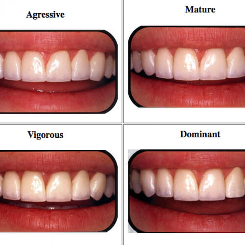 How to Choose the Best Veneers for Your Face Shape - LVI Smile Catalog