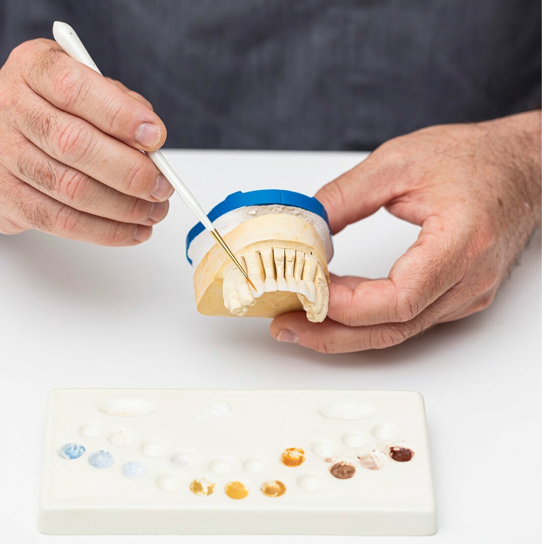 Private Beverly Hills Porcelain Veneers Dental Lab