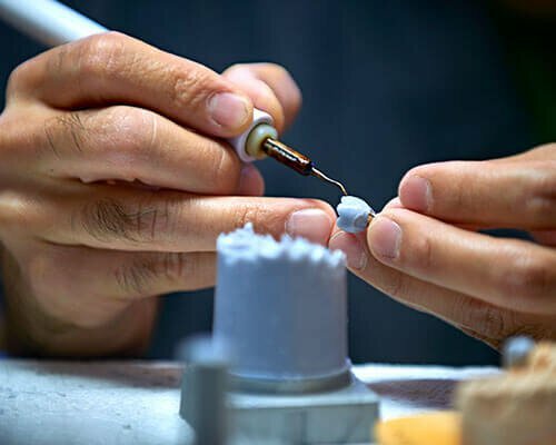 Private Beverly Hills Porcelain Veneers Dental Lab teeth model