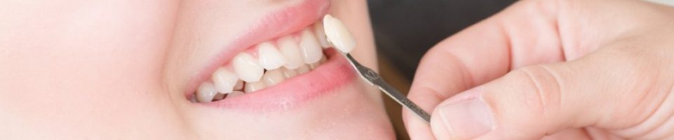 fixing teeth