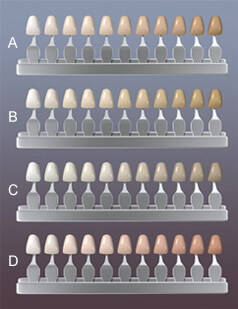 Porcelain Veneers Color Chart