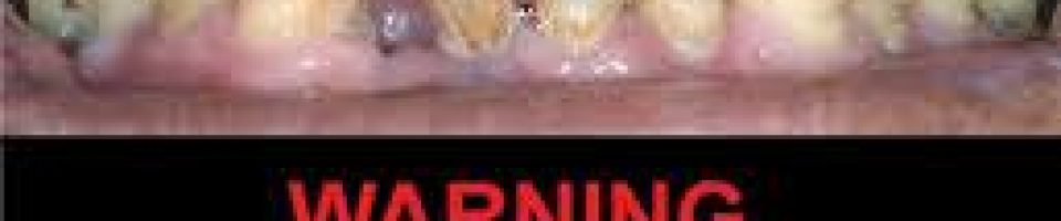 Smoking Leads to Dental Health Complications | Rifkin ...