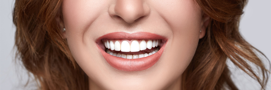 oil pulling patient model smiling broadly showing white teeth