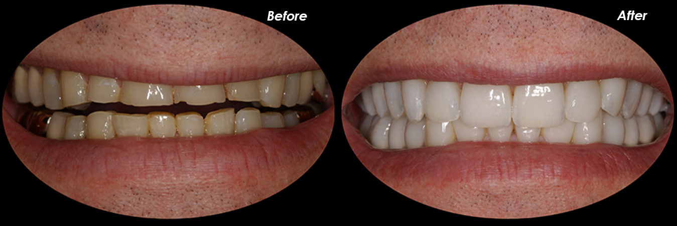 The Most Used Popular Cosmetic Dental Procedures In ... The Most Used Popular Cosmetic Dental Procedures In ...