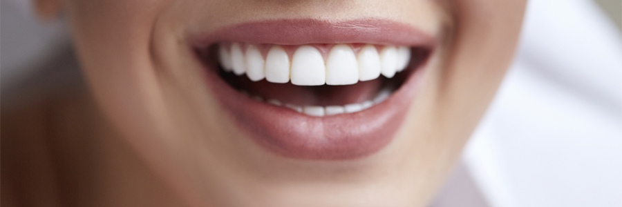 Tooth Whitening